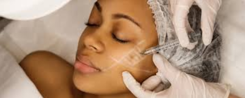Lift Without the Knife: Why Thread Lift in Dubai Is Redefining the Future of Facial Rejuvenation