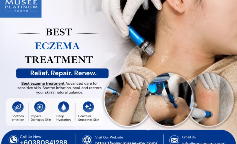 Best Eczema Treatment Options for Dry, Itchy and Cracked Skin