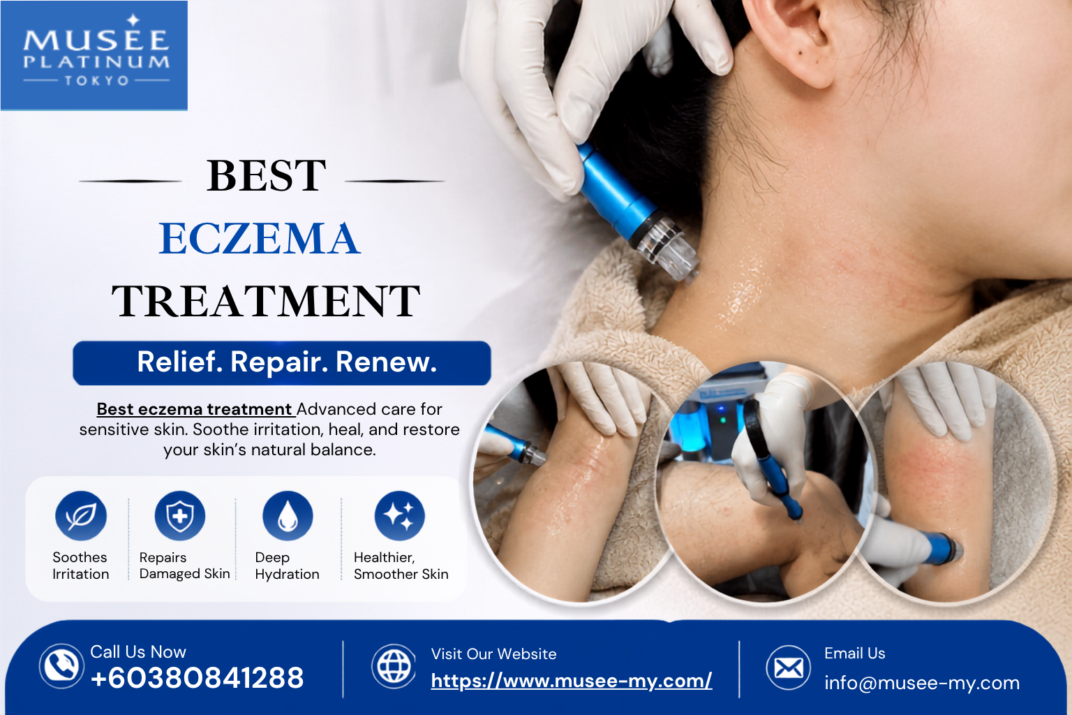 Best Eczema Treatment Options for Dry, Itchy and Cracked Skin
