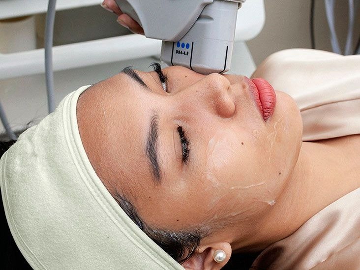 How Does HIFU Treatment Work for Skin Tightening?