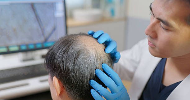 When Can You Return to Work After a Hair Transplant in Riyadh?