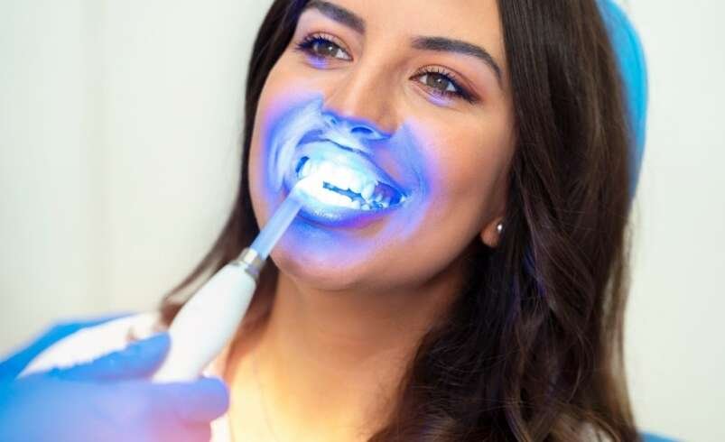 The Pros & Cons of Different Types of Teeth Whitening Treatments