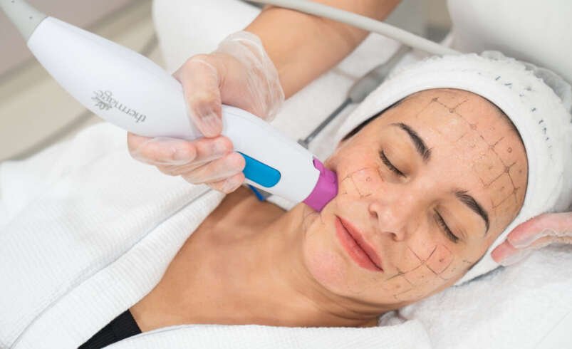 How Thermage Skin Tightening in Dubai Improves Skin Firmness