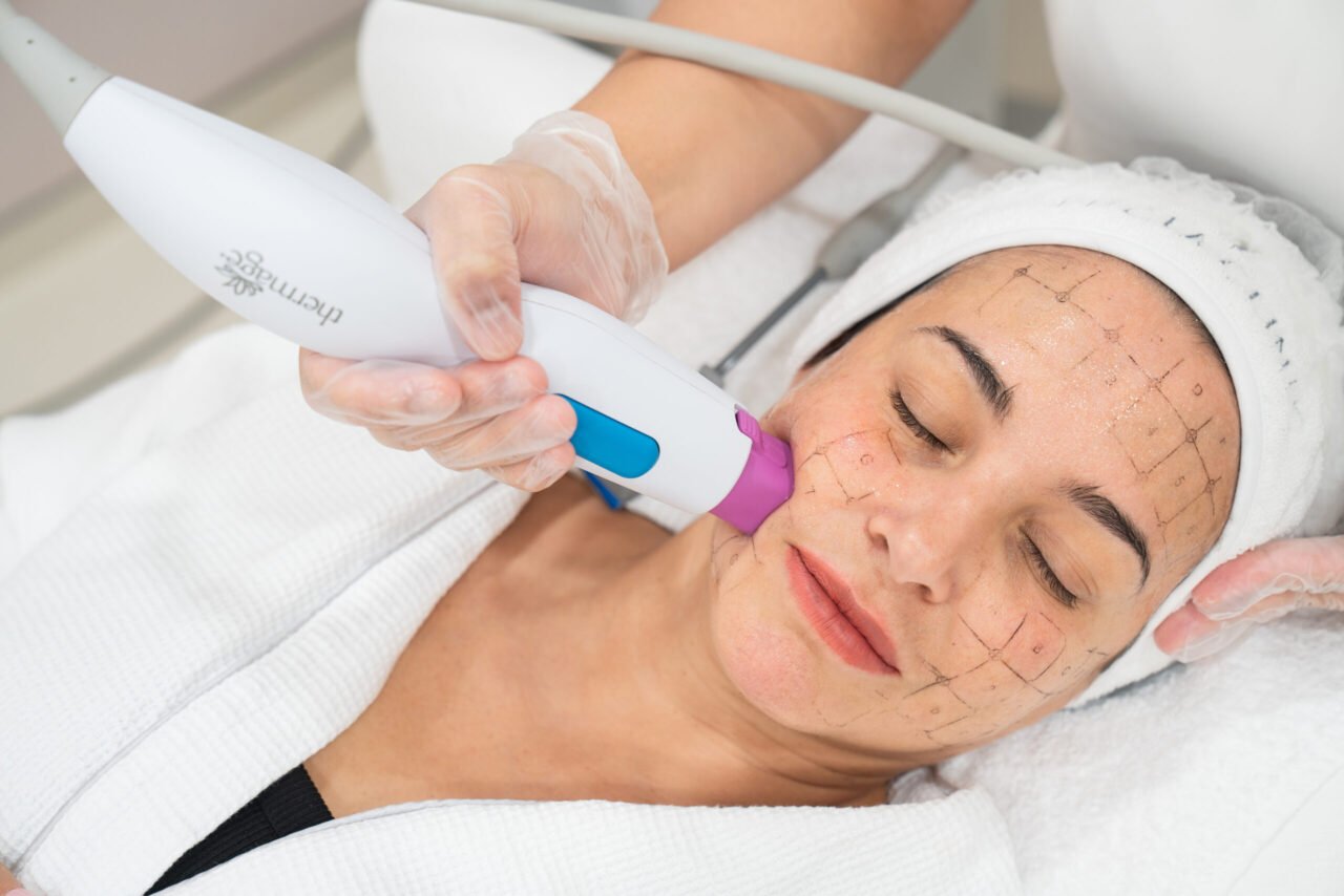 How Thermage Skin Tightening in Dubai Improves Skin Firmness