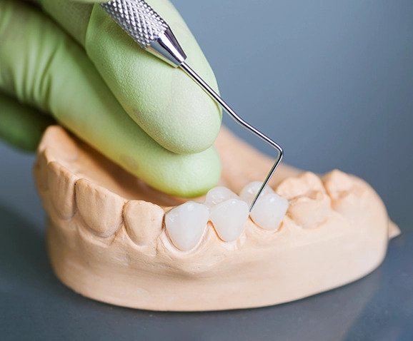 Where can I find affordable dental implants in Irvine and what should I ask before choosing treatment