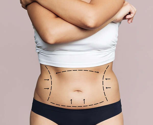 Mini Tummy Tuck Dubai: How Can It Improve the Appearance of the Lower Abdomen?