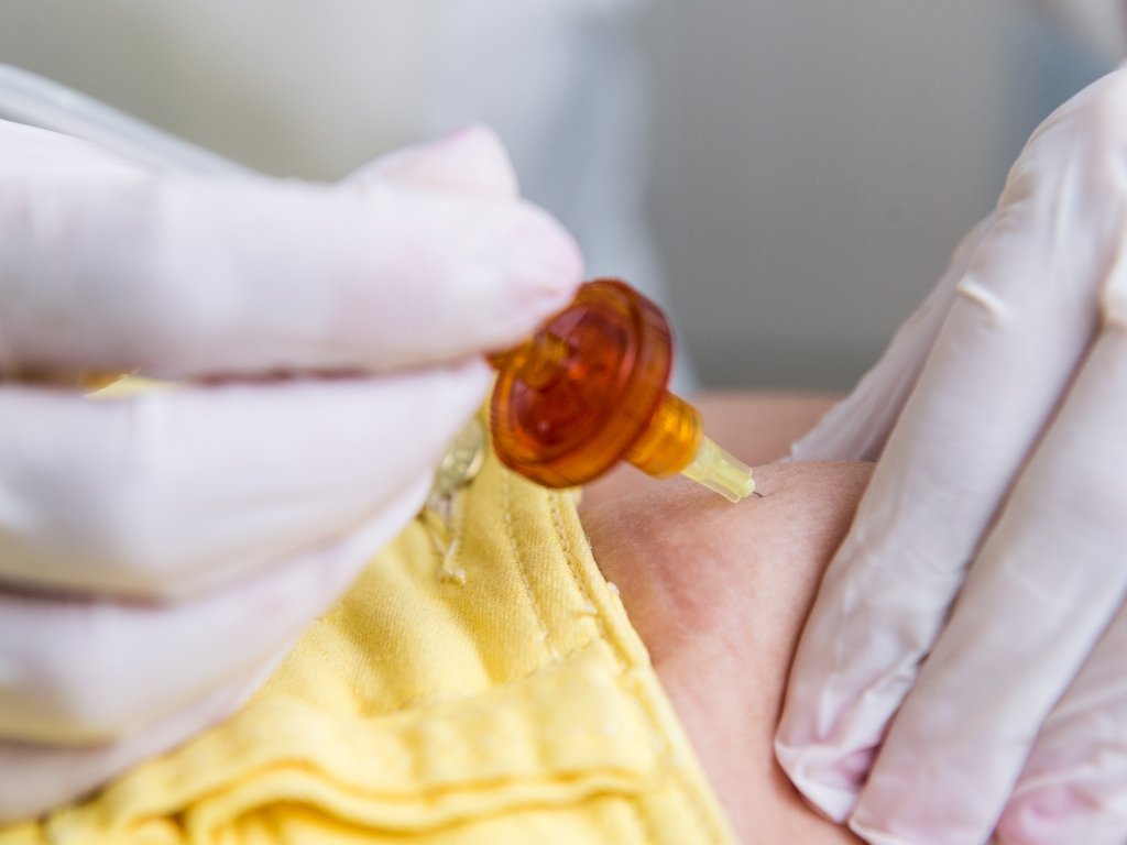Exploring Non Surgical Treatment Options for Fibroid Care