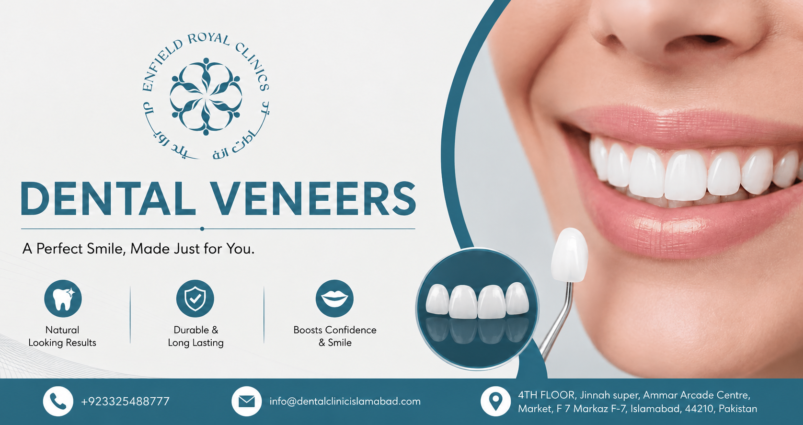 Dental Veneers for a Refined and Natural Smile